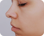 تصویر بعد از درمان