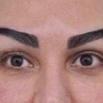 تصویر بعد از درمان