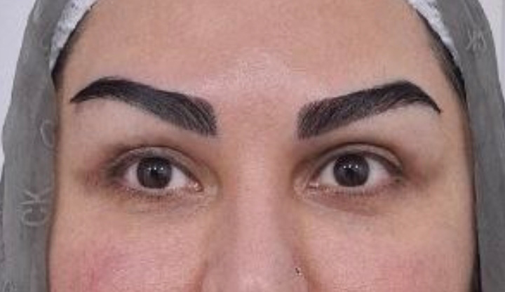 تصویر بعد از درمان