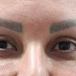 تصویر قبل از درمان