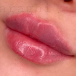 تصویر بعد از درمان