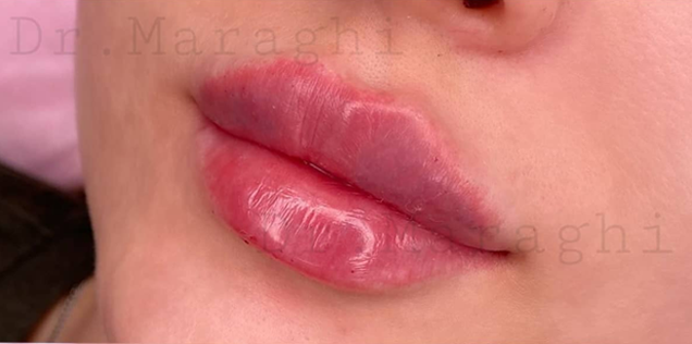 تصویر بعد از درمان