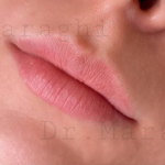 تصویر قبل از درمان