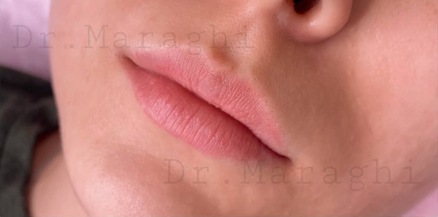 تصویر قبل از درمان