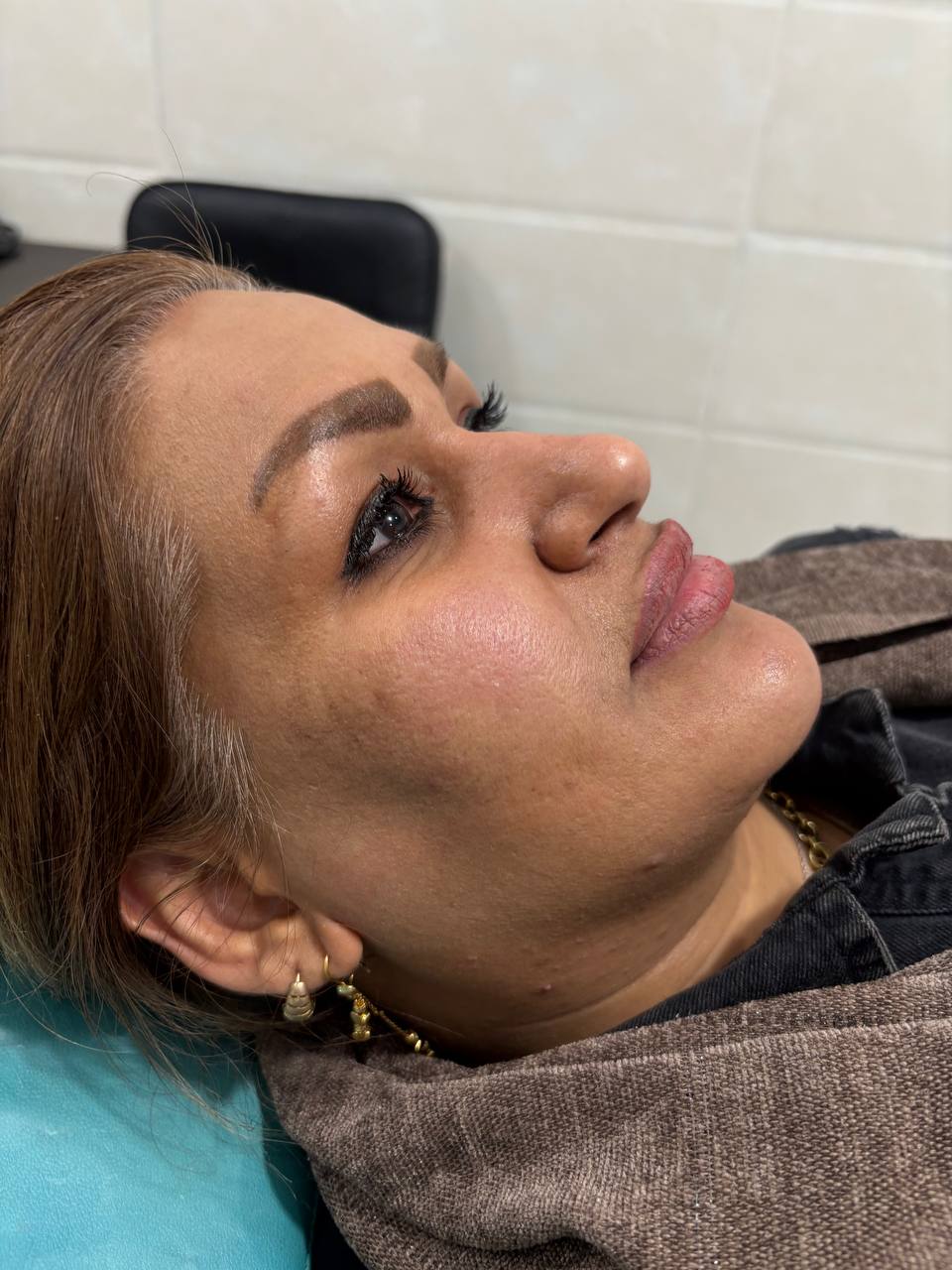 تصویر بعد از درمان