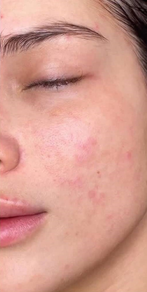 تصویر قبل از درمان