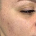 تصویر قبل از درمان