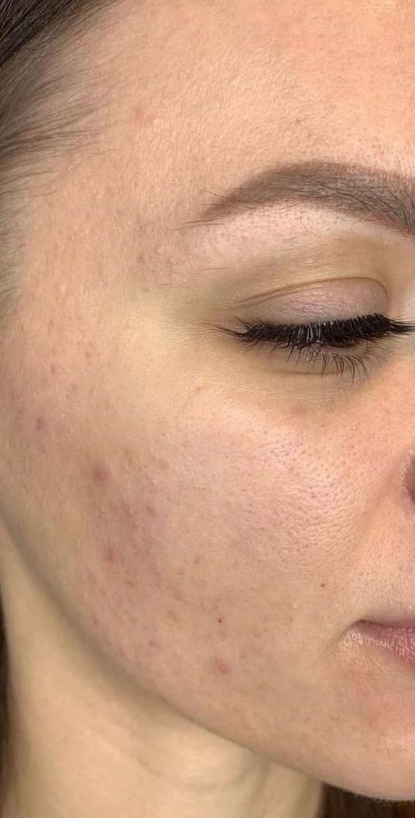 تصویر قبل از درمان