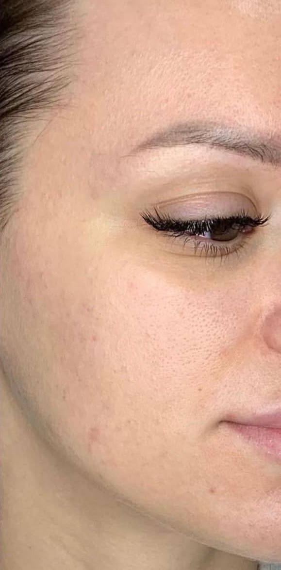 تصویر بعد از درمان