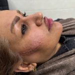 تصویر قبل از درمان