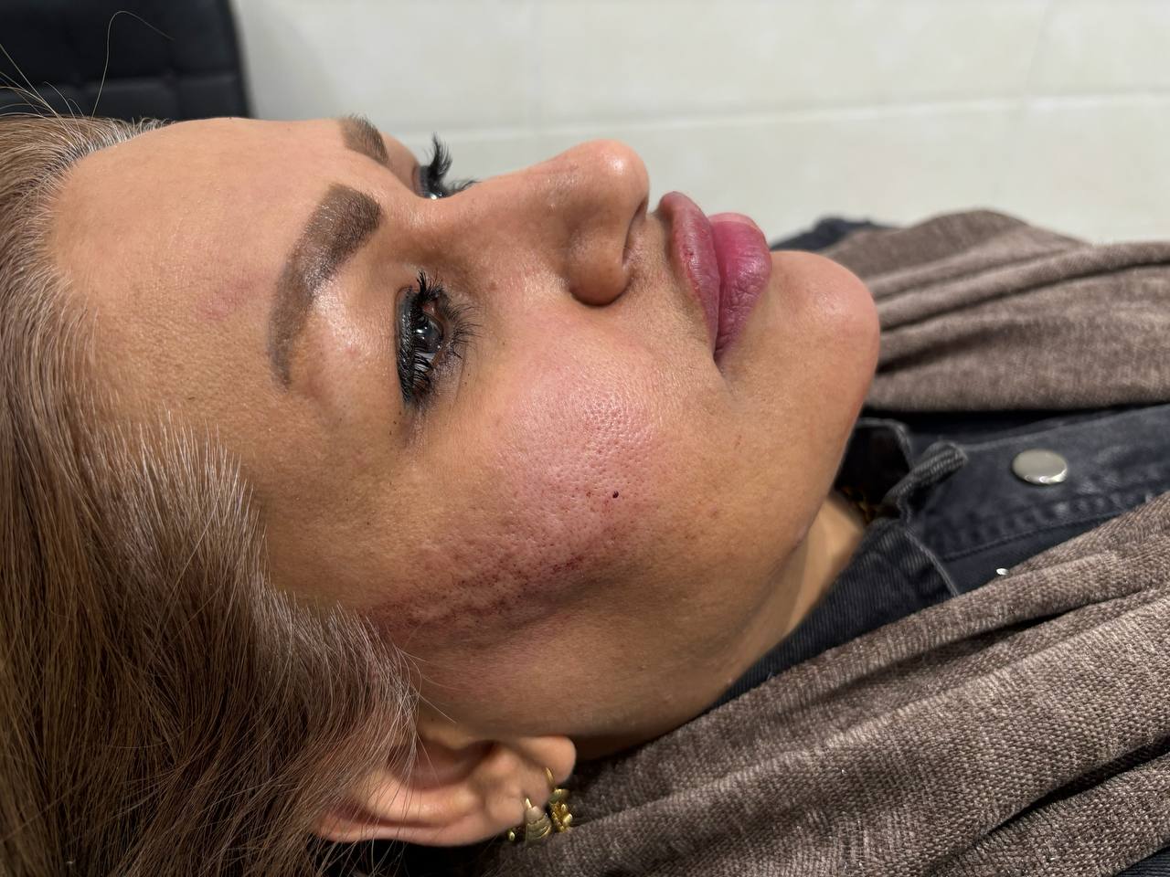 تصویر قبل از درمان