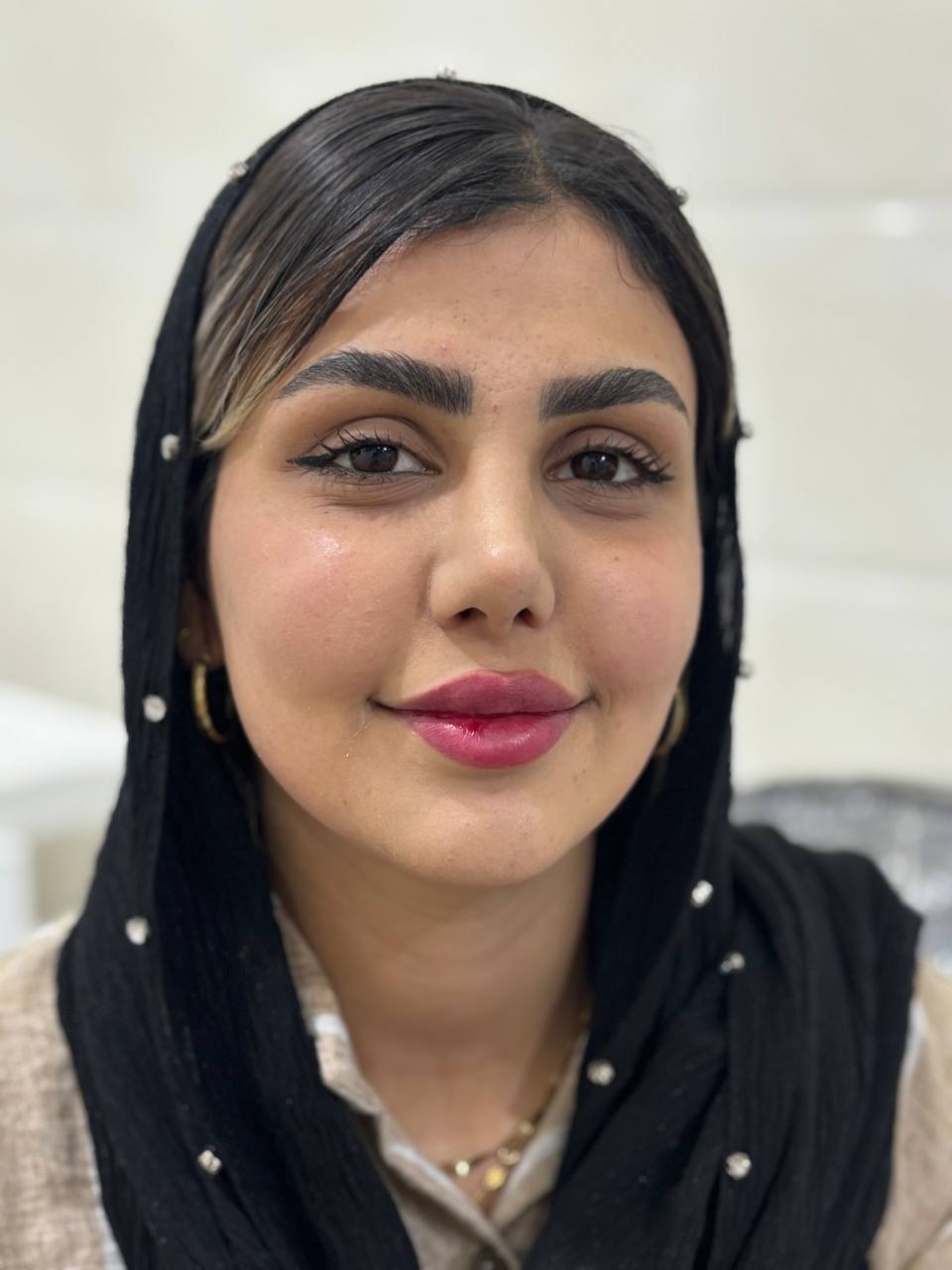 تصویر قبل از درمان