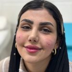 تصویر بعد از درمان