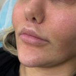 تصویر قبل از درمان