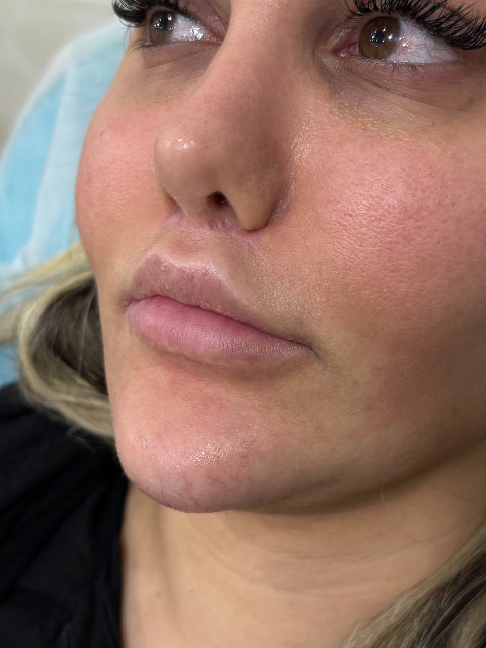 تصویر قبل از درمان