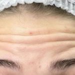 تصویر قبل از درمان