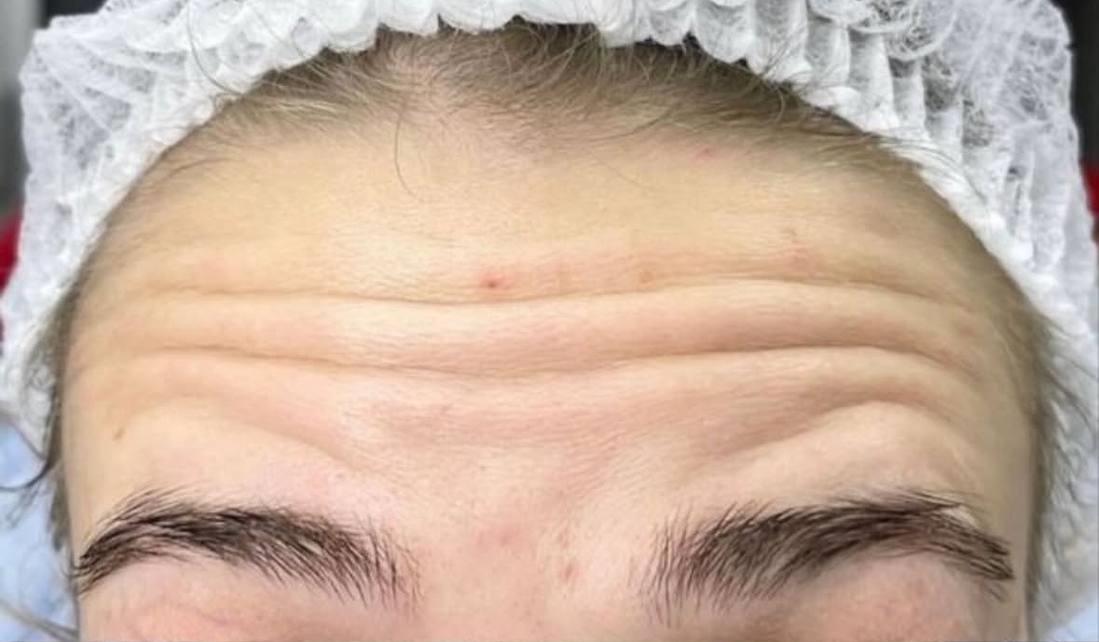 تصویر قبل از درمان