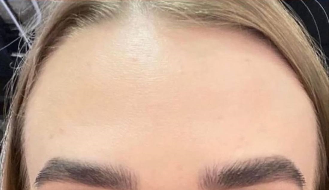 تصویر بعد از درمان